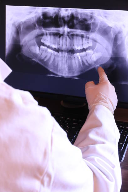 Best Emergency Dental Filling Replacement  in North Rock Springs, WY