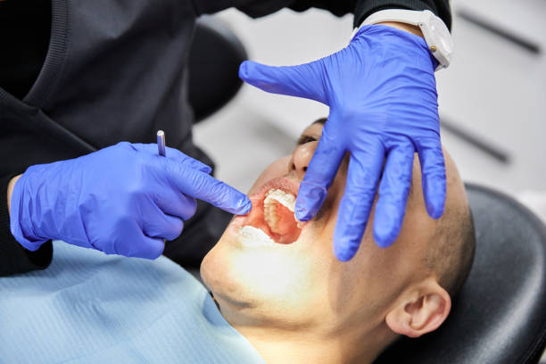 Best Chipped Tooth Repair Near Me  in North Rock Springs, WY